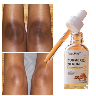 Turmeric Lemon Oil Skin Glow To Lightening Acne Dark Patches